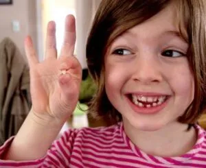 Loose tooth